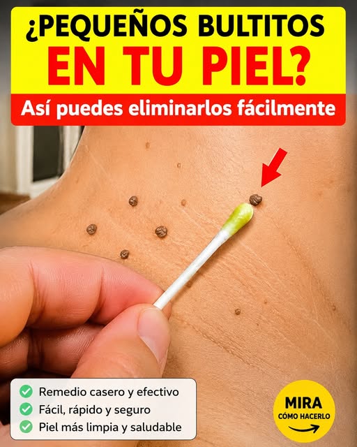 Celidonia fresca: lo que debes saber sobre esta planta tradicional y el cuidado de la piel