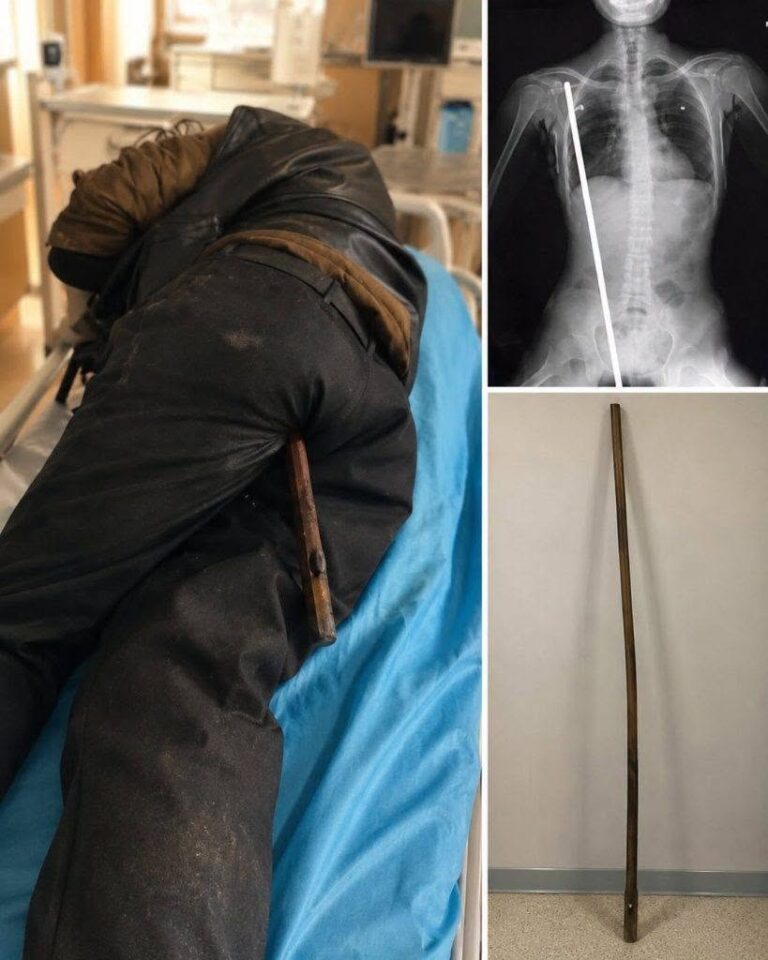 Young man hospitalized after being arrested…See more
